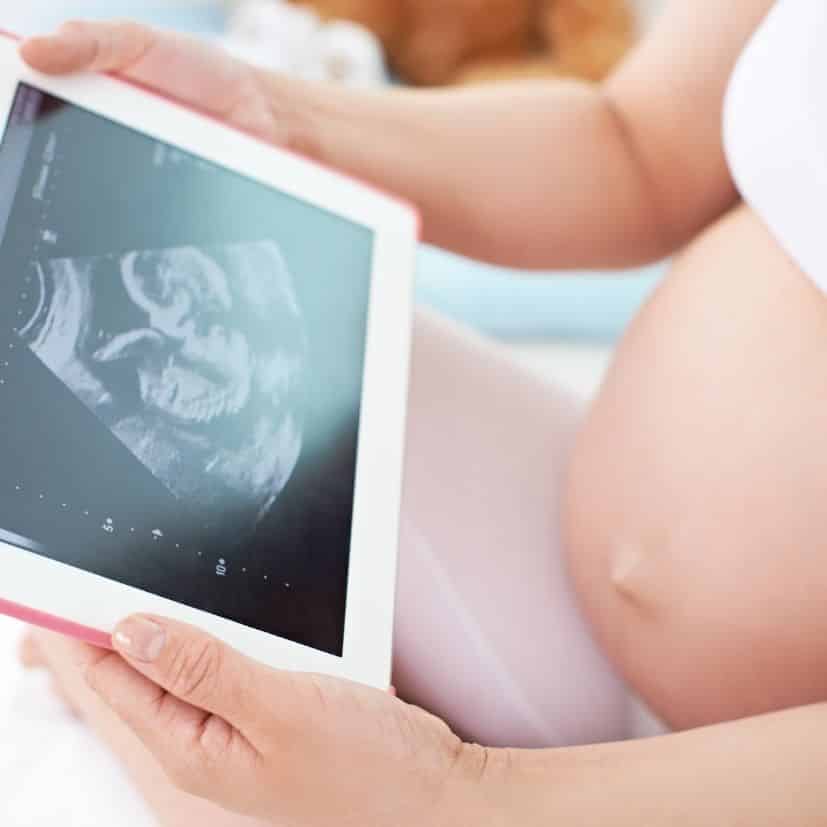 Complicações Diabetes Gestacional