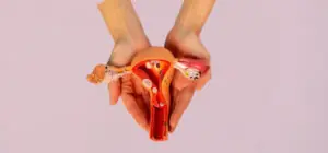 Mulher com fertilidade afetada pelo BPA